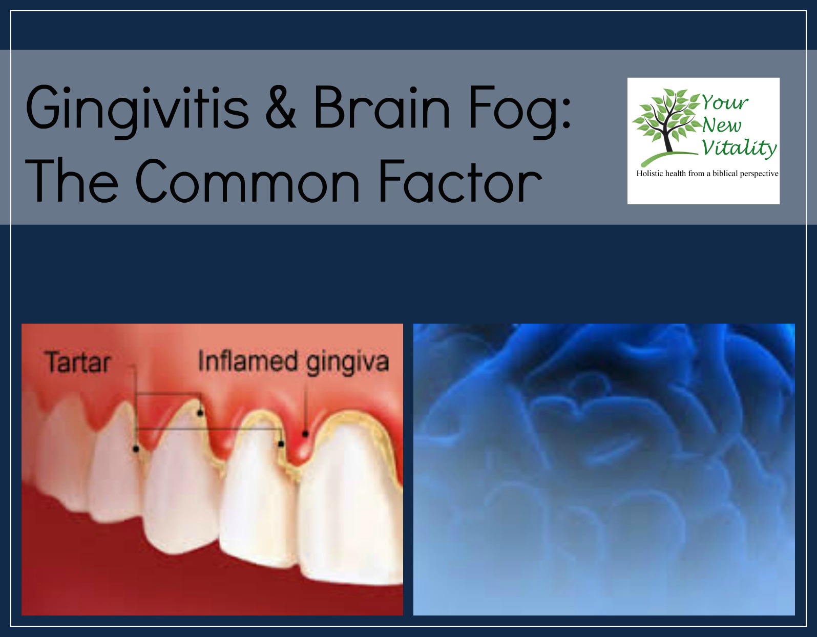 gingivitis brain fog2